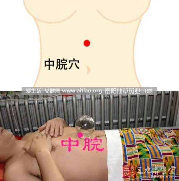 中脘穴位于腹部正中線，臍上4寸的位置上。每天艾灸10-15分鐘，能有效緩解胃部不適的癥狀，同時有助于祛濕。